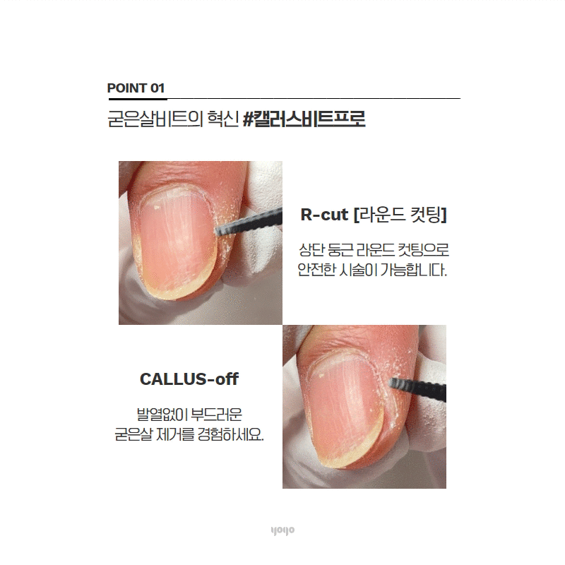 YOGO Mango Pro [Callus]